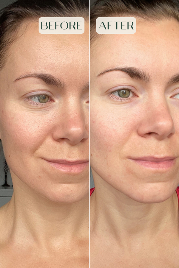 Balancing Facial Serum