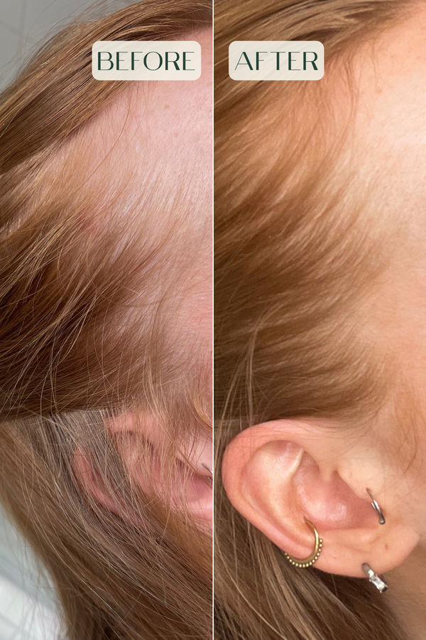 Stimulating Hair Growth Elixir