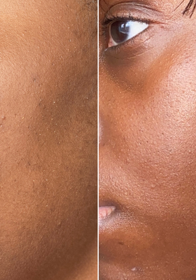 Bakuchiol Antioxidant Complex