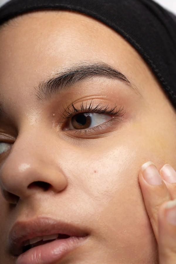 treatment for acne scars london